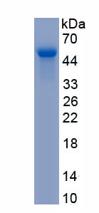 Recombinant Ki-67 Protein (Ki-67)
