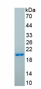 Recombinant Collagen Type VIII Alpha 1 (COL8a1)