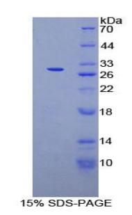 Recombinant Axis Inhibition Protein (AXIN)