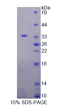 Recombinant G Protein Coupled Receptor Kinase 4 (GRK4)