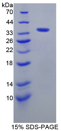 Recombinant A Kinase Anchor Protein 11 (AKAP11)