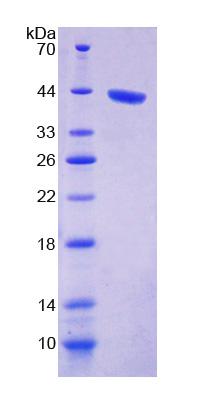 Recombinant Protein Phosphatase 1, Catalytic Subunit Alpha Isoform (PPP1Ca)