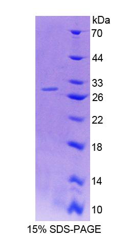 Recombinant Host Cell Factor C1 (HCFC1)