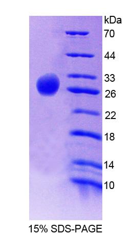 Recombinant G Protein Alpha Z (GNaZ)