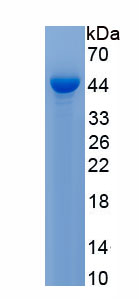 Recombinant Protein Kinase B Alpha (PKBa)