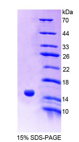 Recombinant Acylphosphatase 2 (ACYP2)