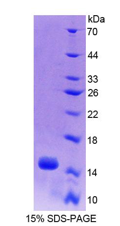 Recombinant Acylphosphatase 2 (ACYP2)