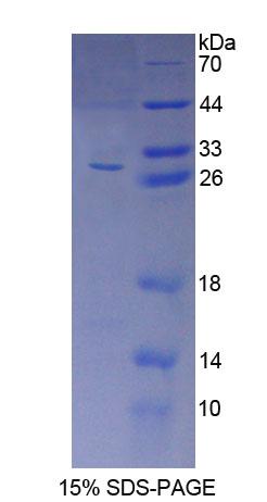 Recombinant Autocrine Motility Factor Receptor (AMFR)