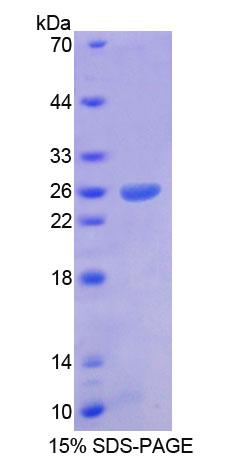 Recombinant Aristaless Related Homeobox Protein (ARX)