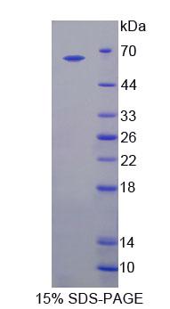 Recombinant Bestrophin 1 (BEST1)