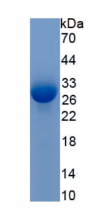 Recombinant C-Src Tyrosine Kinase (CSK)