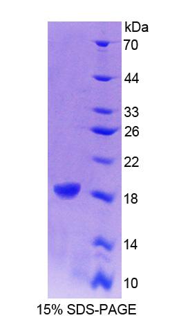 Recombinant Cellular Retinoic Acid Binding Protein 1 (CRABP1)