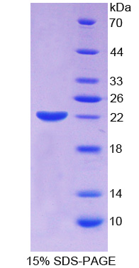 RPC451Hu01.jpg