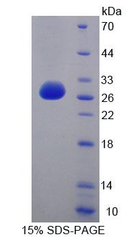 Recombinant Lysophospholipase I (LYPLA1)