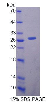 Recombinant Lysophospholipase I (LYPLA1)