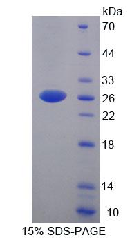 Recombinant YY1 Associated Factor 2 (YAF2)