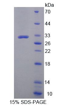Recombinant Zinc Finger Protein 10 (ZNF10)