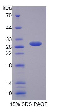 Recombinant Myelin Transcription Factor 1 (MYT1)