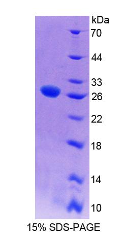 Recombinant Myelin Transcription Factor 1 (MYT1)