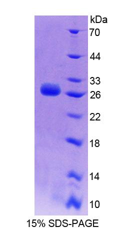 Recombinant Dystrophia Myotonica Protein Kinase (DMPK)