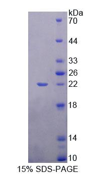 Recombinant Myocyte Specific Enhancer Factor 2A (MEF2A)
