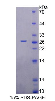 Recombinant Nuclear Autoantigenic Sperm Protein, Histone Binding (NASP)