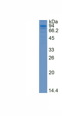 Recombinant Nibrin (NBN)