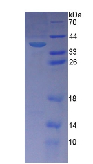 Recombinant Phosphatidylinositol Transfer Protein Beta (PITPNb)