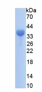 Recombinant Heparan Sulfate Proteoglycan 2 (HSPG2)