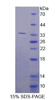 Recombinant Ras Suppressor Protein 1 (RSU1)