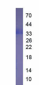 Recombinant Tumor Necrosis Factor Alpha Induced Protein 3 (TNFaIP3)