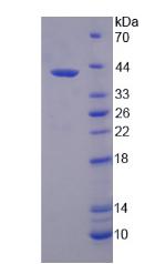 Recombinant S-Phase Kinase Associated Protein 2 (SKP2)