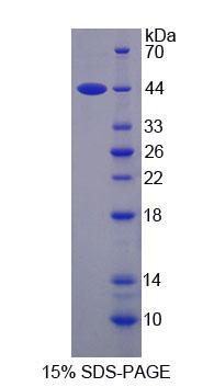 Recombinant Spermine Synthase (SMS)