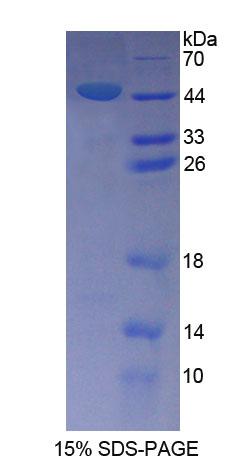 Recombinant Sperm Associated Antigen 1 (SPAG1)
