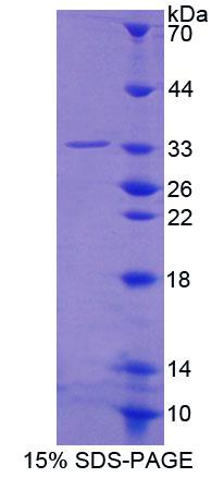 Recombinant Spindlin 1 (SPIN1)