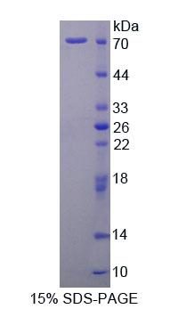 Recombinant Signal Transducing Adaptor Molecule 2 (STAM2)