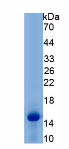 Recombinant Corticotropin Releasing Hormone Receptor 1 (CRHR1)