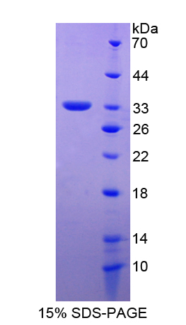 Recombinant Amyloid Beta Precursor Protein Binding Protein A2 (APBA2)