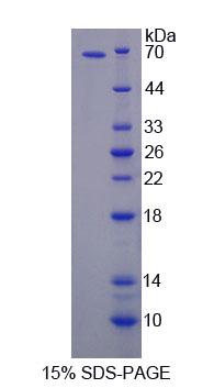 Recombinant Amyloid Beta Precursor Protein Binding Protein B2 (APBB2)