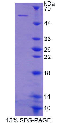 Recombinant Tyrosyl tRNA Synthetase (YARS)