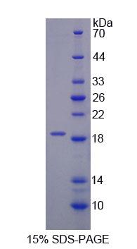 Recombinant Aspartyl tRNA Synthetase (DARS)