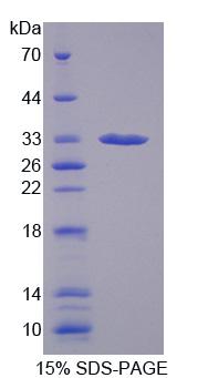 Recombinant Carbonic Anhydrase XIII (CA13)
