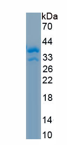 Recombinant Arachidonate-12-Lipoxygenase, 12R Type (ALOX12B)