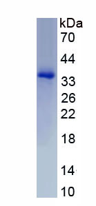 Recombinant Hemoglobin Beta (HBb)