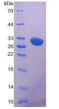 Recombinant Low Density Lipoprotein Receptor Related Protein 5 (LRP5)