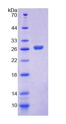 Recombinant Low Density Lipoprotein Receptor Related Protein 1B (LRP1B)