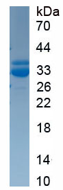 Recombinant N-Acetyl Alpha-D-Glucosaminidase (NAGLU)