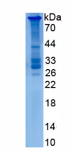 RPD184Hu01.jpg