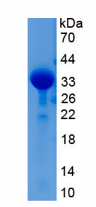 Recombinant Collagen Type II Alpha 1 (COL2a1)