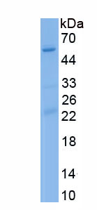 Recombinant Cyclin Dependent Kinase 8 (CDK8)